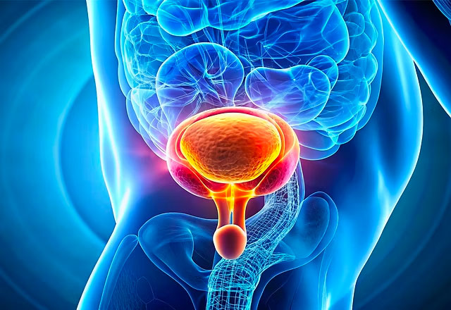 Pelvic Point Centro